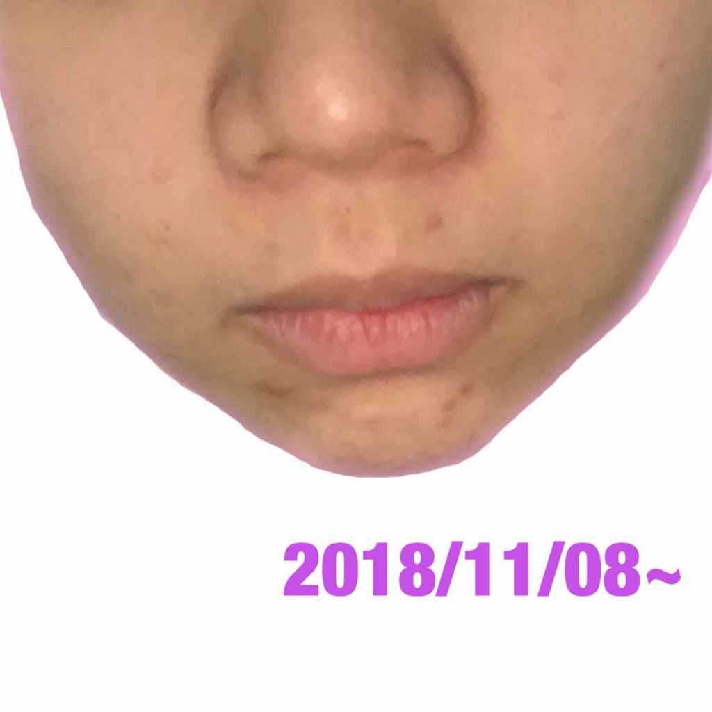 チョコラBBプラス (医薬品)/チョコラBB/その他を使ったクチコミ（3枚目）