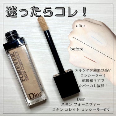 【旧】ディオールスキン フォーエヴァー スキン コレクト コンシーラー/Dior/リキッドコンシーラーを使ったクチコミ（1枚目）