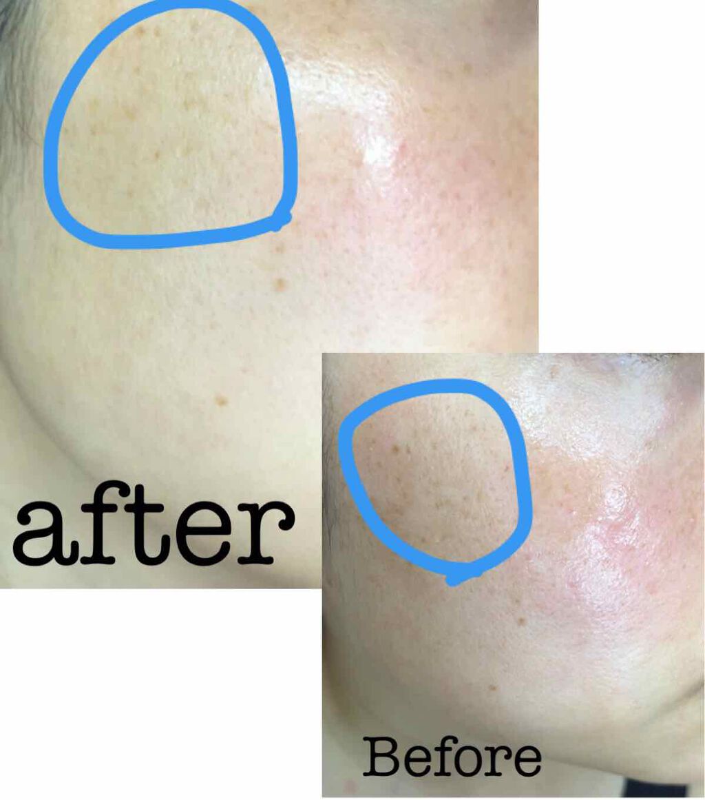 ホワイトラッシュ/アンドシーム/フェイスクリームを使ったクチコミ(3枚目)