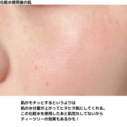 ピンクティーツリートナー/APLIN/化粧水を使ったクチコミ(6枚目)