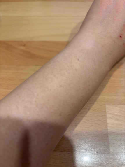 ディオールスキン フォーエヴァー スキン コレクト コンシーラー/Dior/リキッドコンシーラーを使ったクチコミ(5枚目)