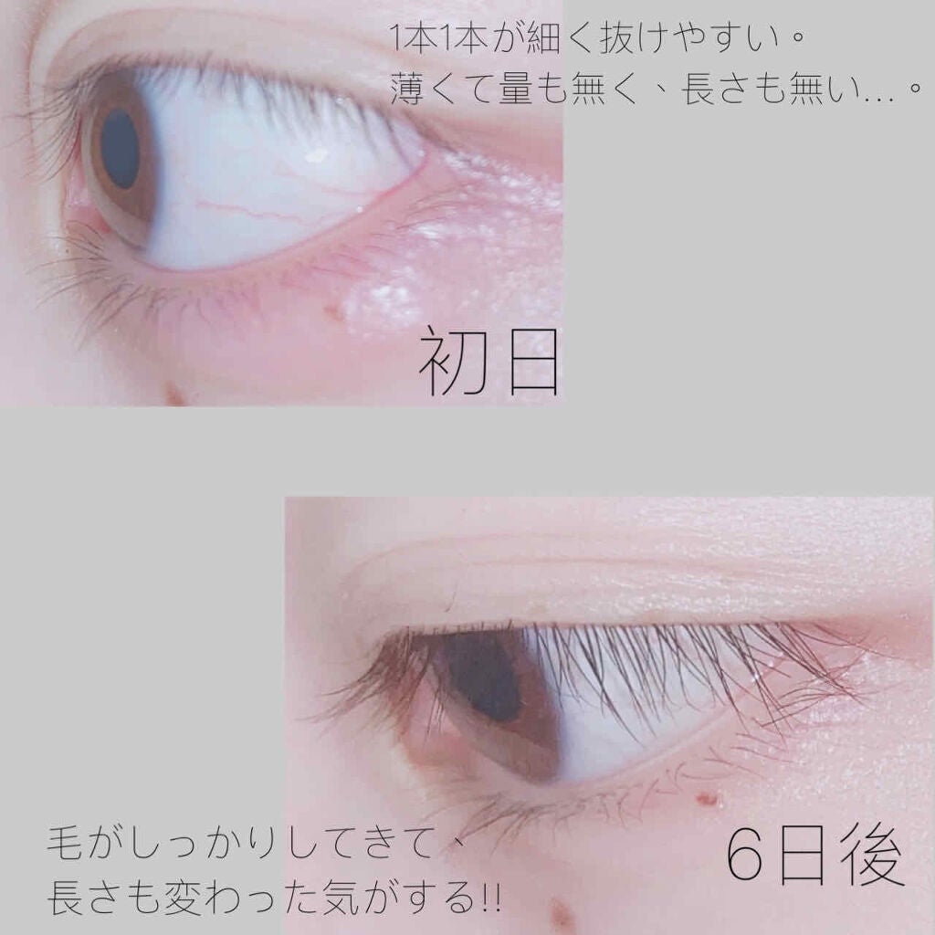 スカルプD ボーテ ピュアフリーアイラッシュセラム/アンファー(スカルプD)/まつげ美容液を使ったクチコミ(2枚目)