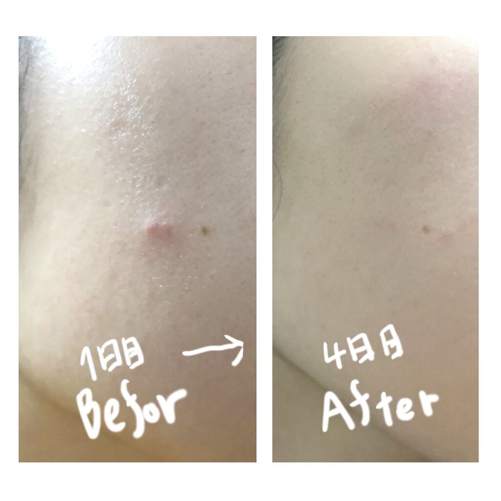 オーガニアンス ウォータリー エッセンス/primera/化粧水を使ったクチコミ(4枚目)