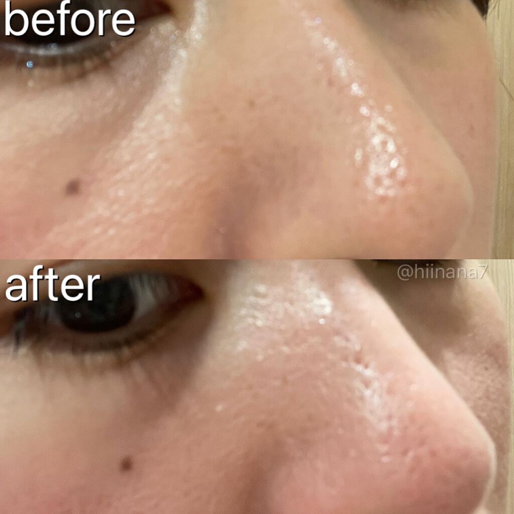 ノーモアブラックヘッド(ノーズピーリング)/One-day's you/スクラブ・ゴマージュを使ったクチコミ(5枚目)