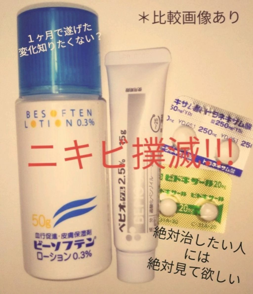 薬用洗顔フォーム/スキンライフ/洗顔フォームを使ったクチコミ（1枚目）