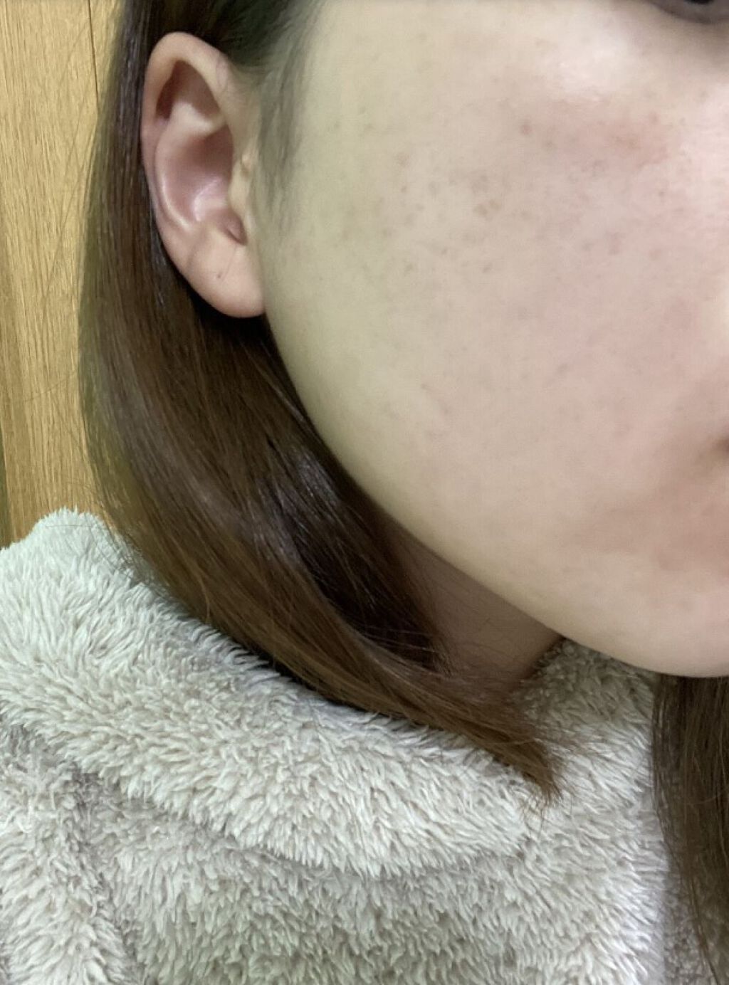 モイスチャー ミストローションII（しっとり）/アルージェ/ミスト状化粧水を使ったクチコミ（1枚目）