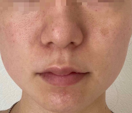 ハトムギ化粧水(ナチュリエ スキンコンディショナー R )/ナチュリエ/化粧水を使ったクチコミ(2枚目)