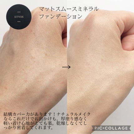 スターターキット(マット)/エトヴォス/トライアルキットを使ったクチコミ(3枚目)