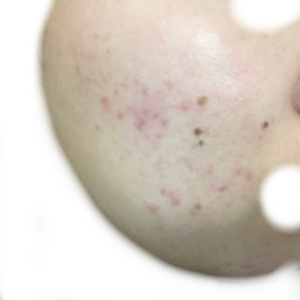 デュオ ザ クレンジングバーム クリア/DUO/クレンジングバームを使ったクチコミ(2枚目)