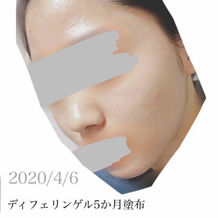 クリーミィタップミネラルファンデーション/SPF42・PA+++/エトヴォス/クリーム・エマルジョンファンデーションを使ったクチコミ(1枚目)