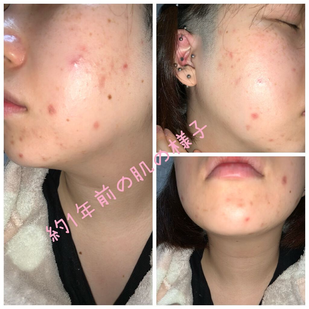 CICAフェイスクリーム/ピコモンテ/フェイスクリームを使ったクチコミ（2枚目）