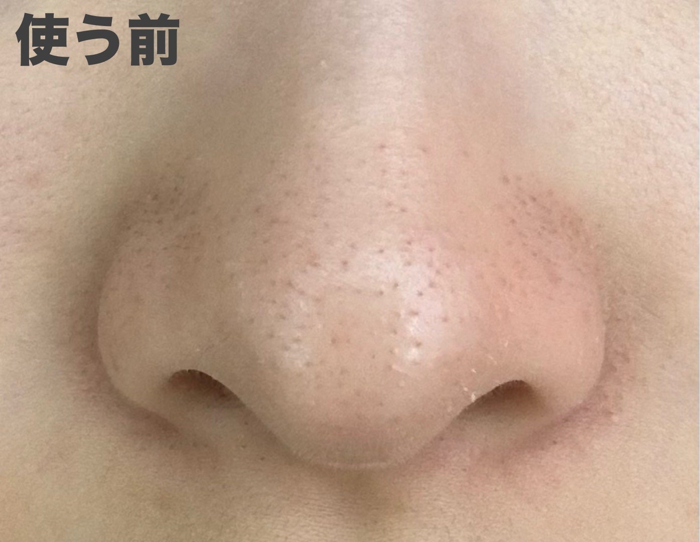 ノーズピーリングパック/One-day's you/シートマスク・パックを使ったクチコミ(2枚目)