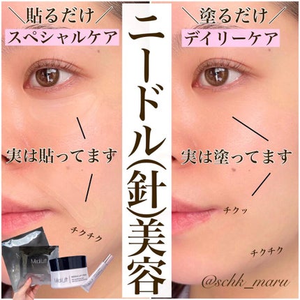 メディリフト ニードルリフトクリーム/YA-MAN TOKYO JAPAN/フェイスクリームを使ったクチコミ(1枚目)