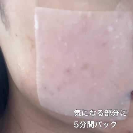 リズム べース ポイント集中パック(シャイン)/RISM/シートマスク・パックを使ったクチコミ(3枚目)
