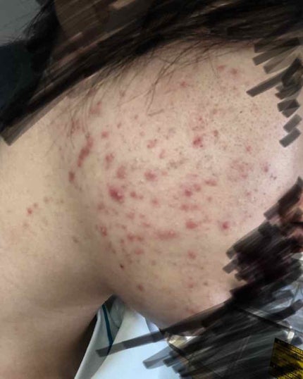 を使ったクチコミ(2枚目)