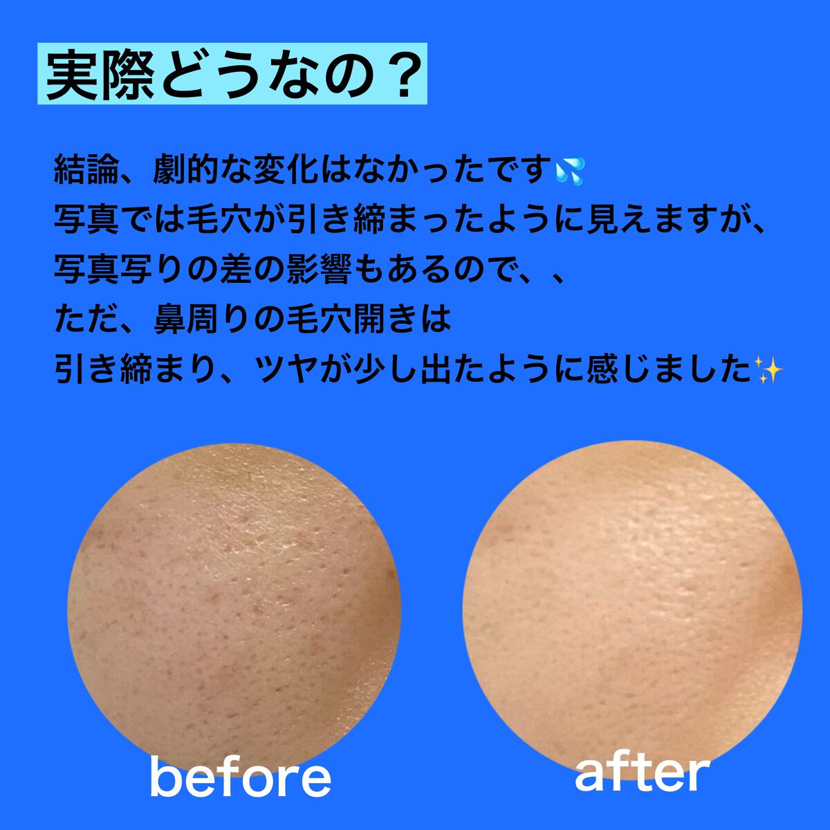 タカミスキンピール/タカミ/ブースター・導入液を使ったクチコミ（3枚目）