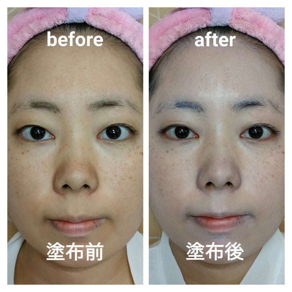 UVã«ãã ãã€ããªã¢UVããŒã·ã§ã³/ãã¥ã¬ã«/æ¥çŒãæ¢ãã»UVã±ã¢ã䜿ã£ãã¯ãã³ãïŒ2æç®ïŒ