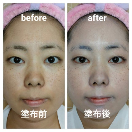 UVã«ãã ãã€ããªã¢UVããŒã·ã§ã³/ãã¥ã¬ã«/æ¥çŒãæ¢ãã»UVã±ã¢ã䜿ã£ãã¯ãã³ãïŒ2æç®ïŒ