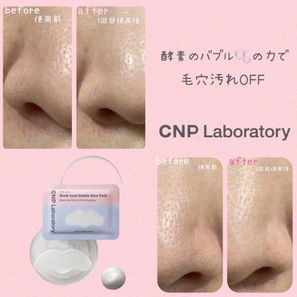 鼻 バブルパック/CNP Laboratory/シートマスク・パックを使ったクチコミ(5枚目)