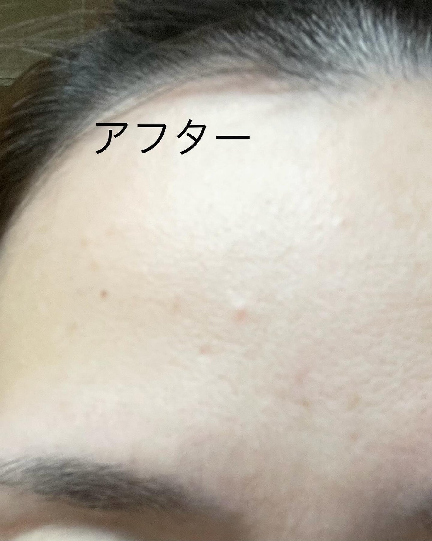 レモン on LIPS 「24時間いつでも使えるスキンケアパウダーが、スキンケア&メイク..」(6枚目)