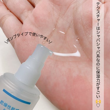 ▶︎キュレル
　潤浸保湿 化粧水 III とてもしっとり
　【医薬部外品】

　本体 150ml　¥2,090(税込)

────────────

キュレルさんから【潤浸保湿 化粧水 III とてもしっとり】を頂いたのでご紹介🙌♡


保湿系のスキンケアはとろっとしたテクスチャーのイメージでしたが、この化粧水はシャバシャバタイプなのに仕上がりはしっかりしっとりしてて驚いた🥺！

冬はどうしても乾燥する、、、だけどとろっとタイプが苦手って方にもこれからの季節いいかと思います😌


プッシュタイプで使いやすいのでお風呂上がりの乾燥もササっと保湿できるのもありがたい♡



肌荒れを防ぐ潤い成分配合。
☑︎無香料　☑︎無着色　☑︎アルコールフリー
☑︎弱酸性　☑︎アレルギーテスト済み
☑︎敏感肌の方の協力によるパッチテスト済み


気になる方はチェックしてみて下さい♡






#キュレル #モニター_キュレル #化粧水 #乾燥肌_敏感肌 #curel  #提供  の画像 その1