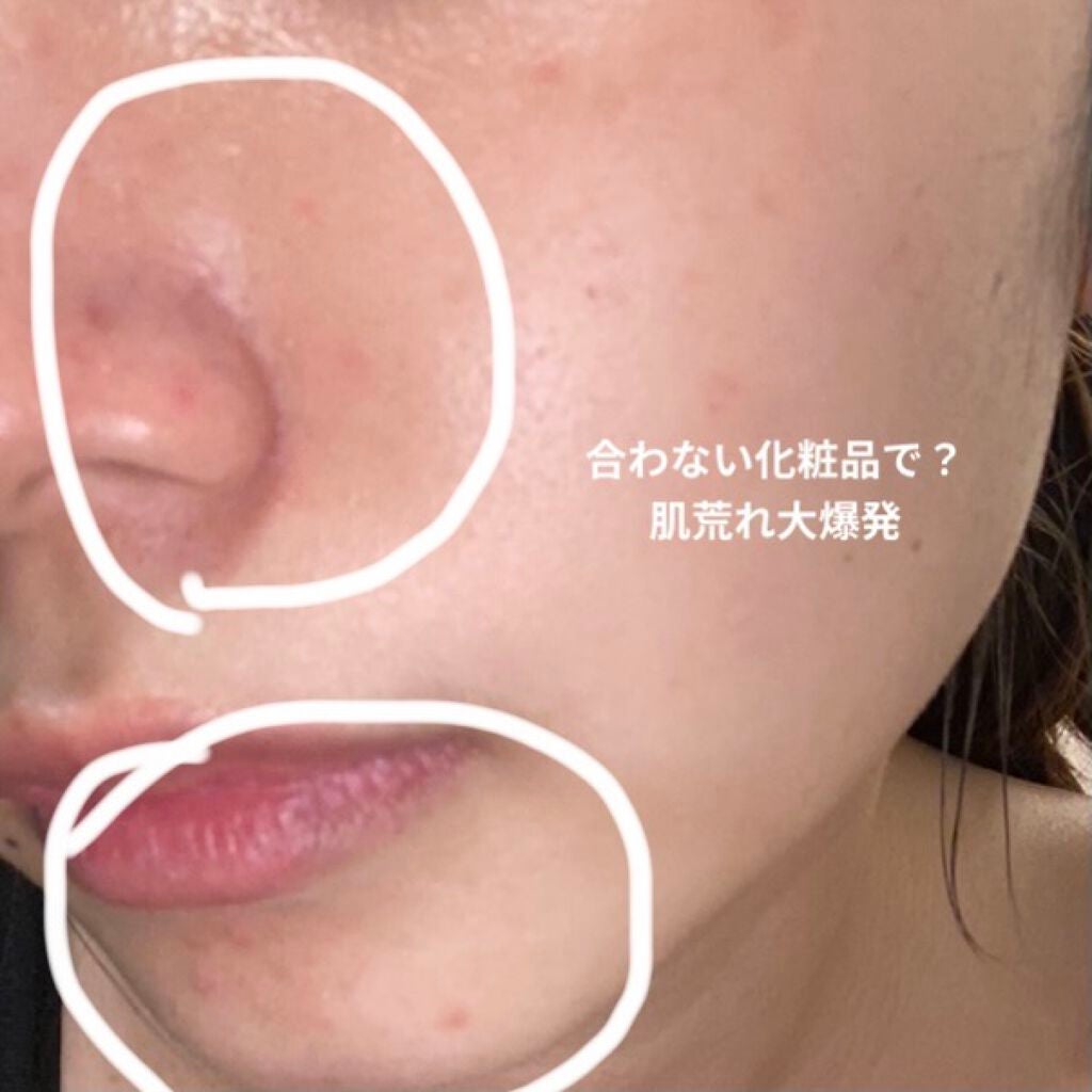 ニベアクリーム/ニベア/ボディクリームを使ったクチコミ(3枚目)