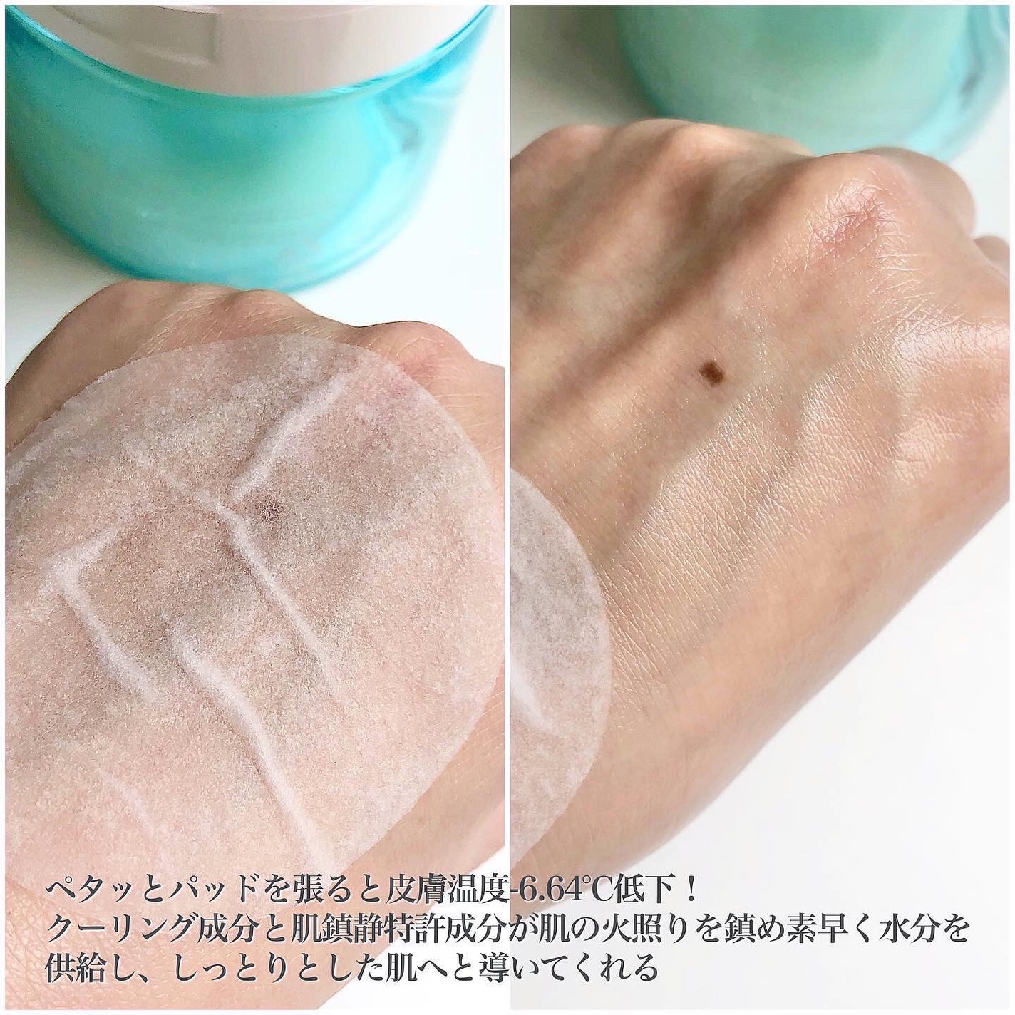 ヘルプミー! アイスクーリングパッド/One-day's you/トナーパッドを使ったクチコミ(2枚目)