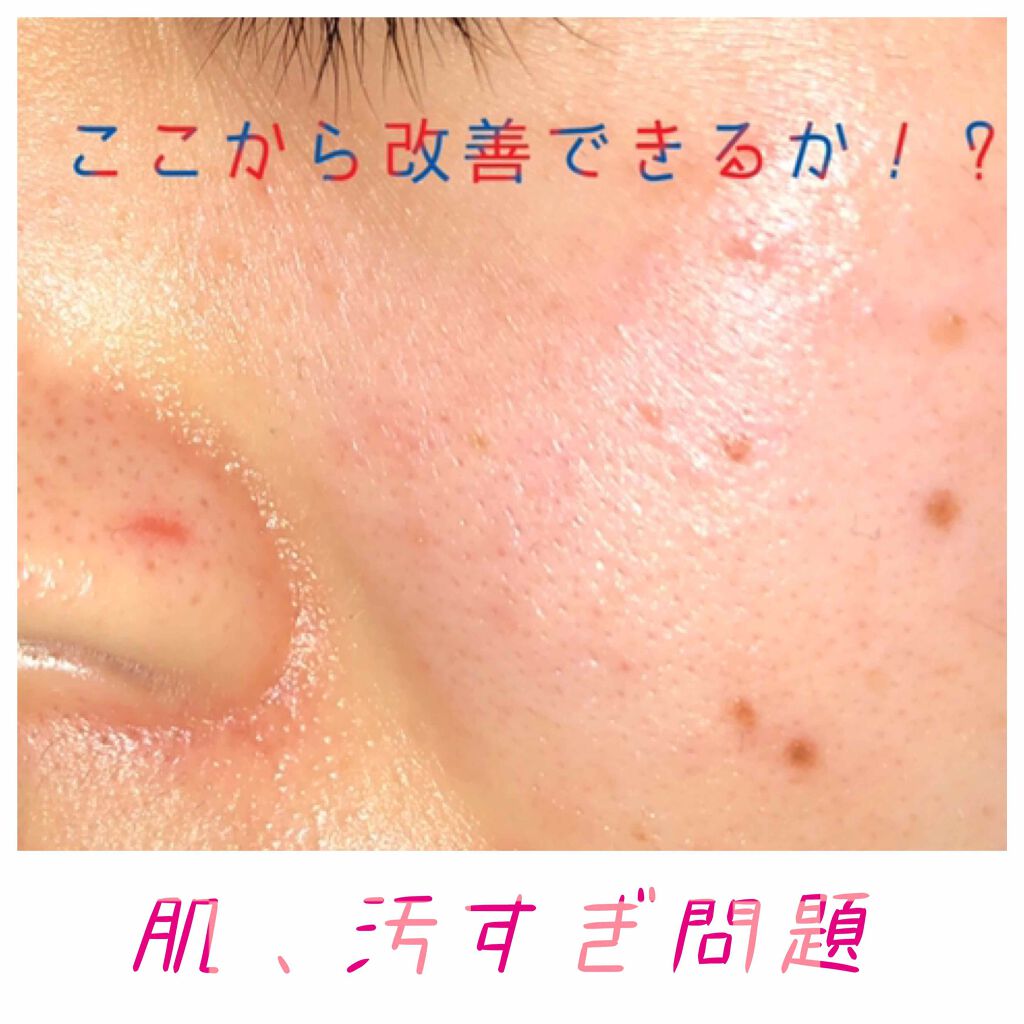 ホホバオイル/無印良品/ボディオイルを使ったクチコミ（1枚目）