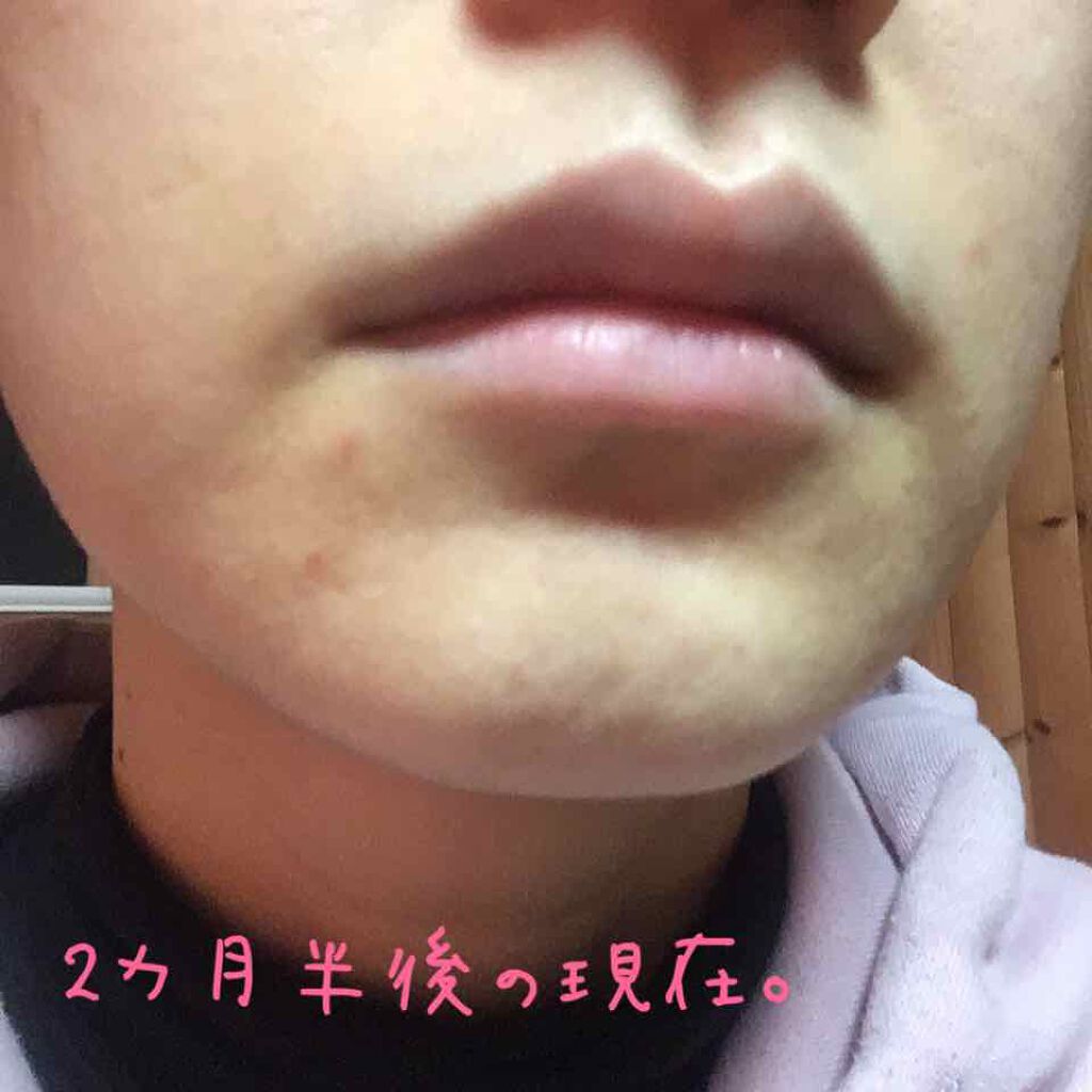 ドクタージャルト シカペア クリーム (第2世代)/Dr.Jart+/フェイスクリームを使ったクチコミ(4枚目)