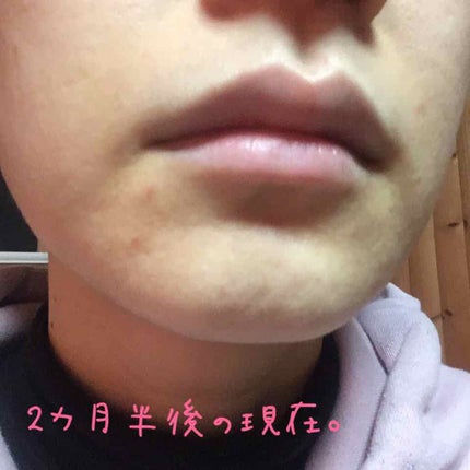 ドクタージャルト シカペア クリーム (第2世代)/Dr.Jart+/フェイスクリームを使ったクチコミ(4枚目)