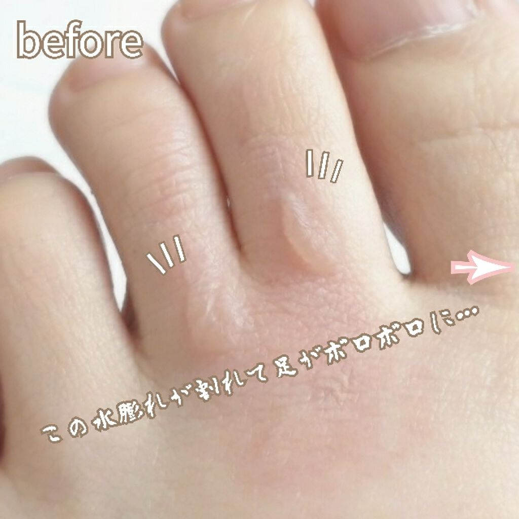 ニノキュア(医薬品)/ニノキュア/その他を使ったクチコミ(2枚目)