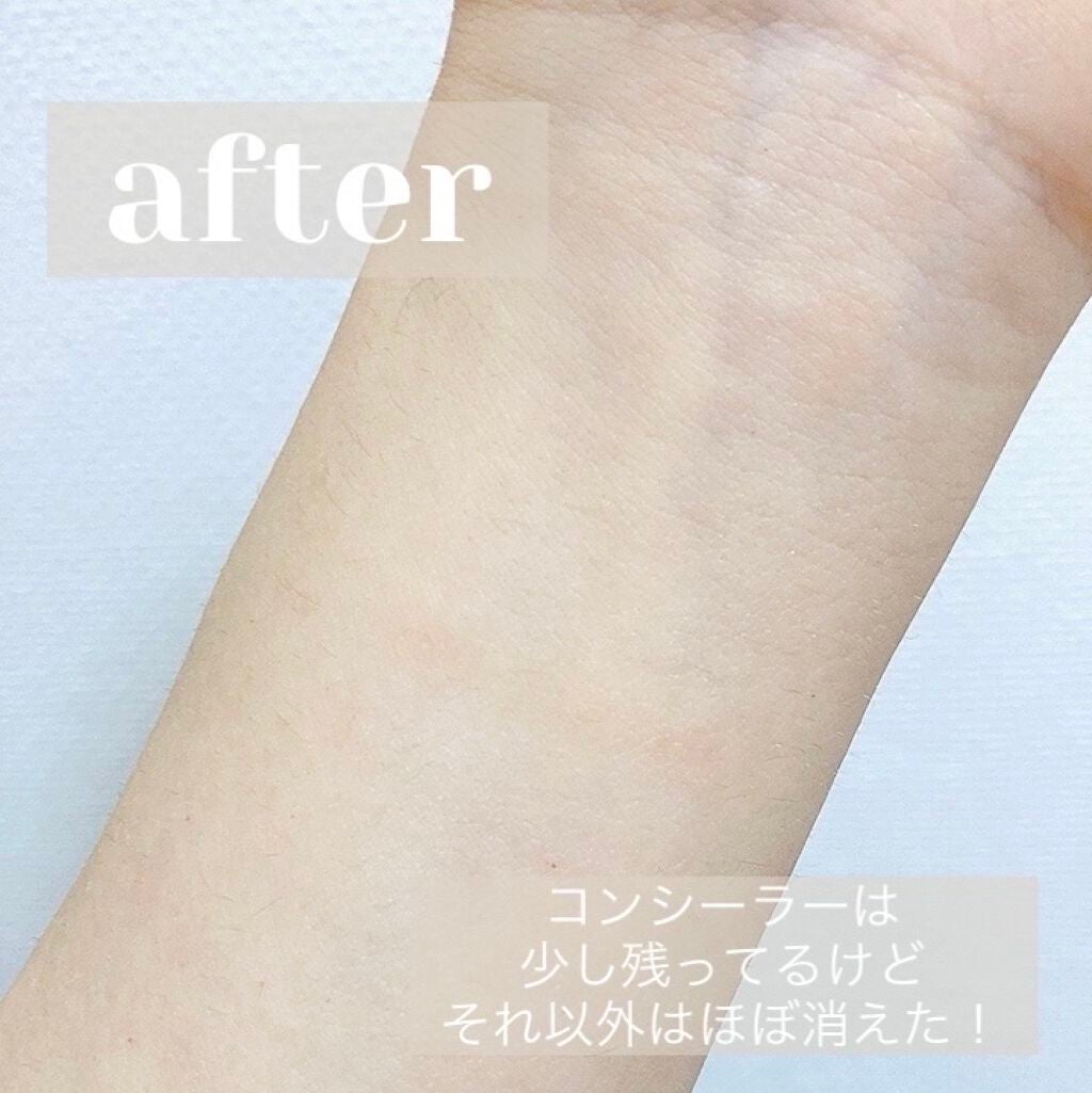 サンシビオ エイチツーオー D/ビオデルマ/クレンジングウォーターを使ったクチコミ(3枚目)