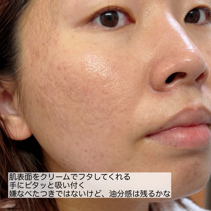 リペア薬用保湿化粧水 しっとり/コラージュ/化粧水を使ったクチコミ(9枚目)