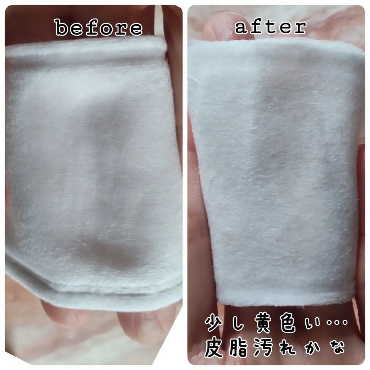 オードムーゲ トライアルセット/オードムーゲ/トライアルキットを使ったクチコミ（3枚目）