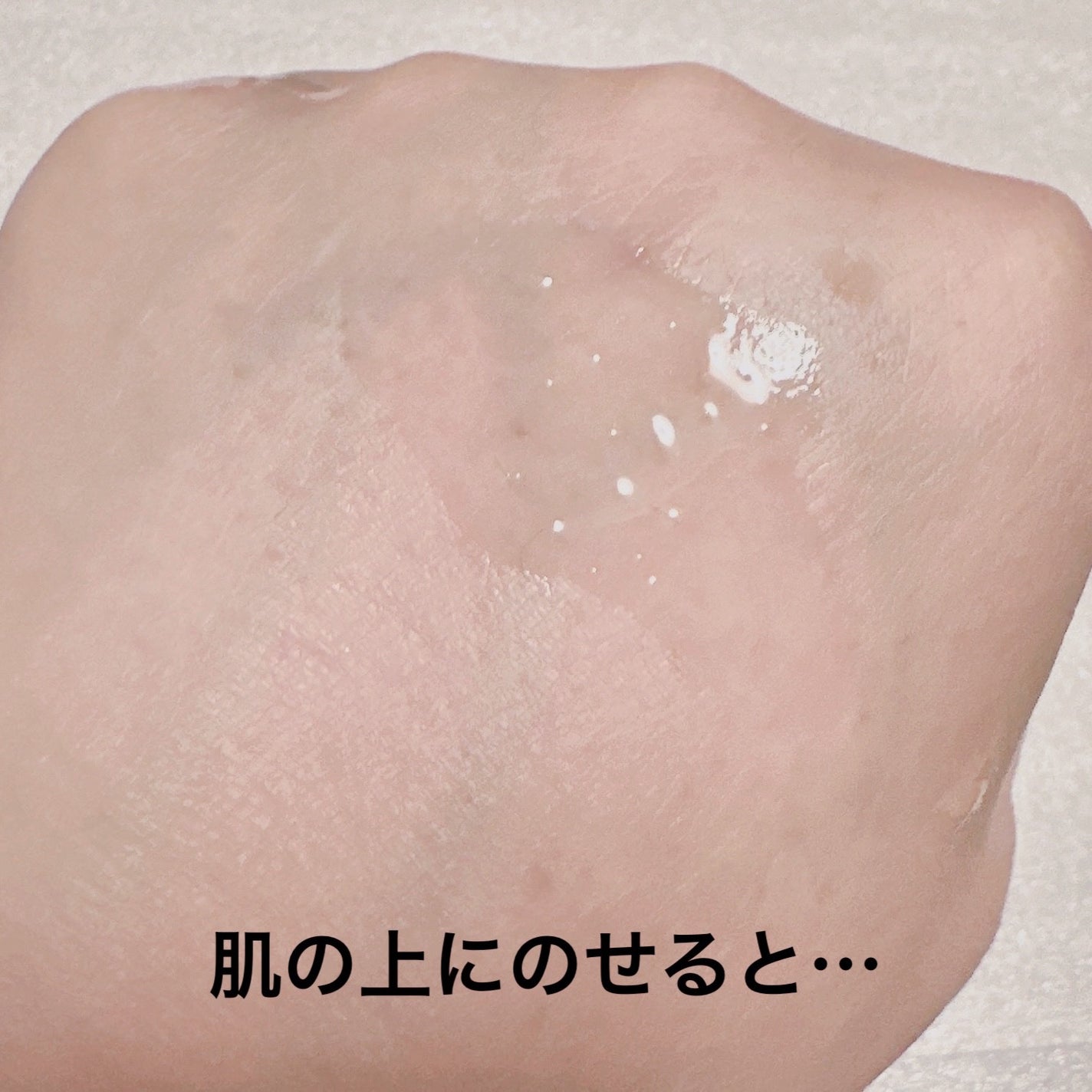 ダーマレーザースペクター ウルセラCMAX/クオリティファースト/美容液を使ったクチコミ(4枚目)