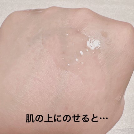 ダーマレーザースペクター ウルセラCMAX/クオリティファースト/美容液を使ったクチコミ(4枚目)