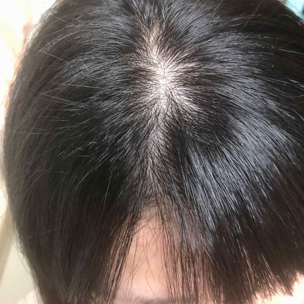 ヘッドスパセブン トリートメント/ヘッドスパセブン/頭皮トリートメントを使ったクチコミ（3枚目）