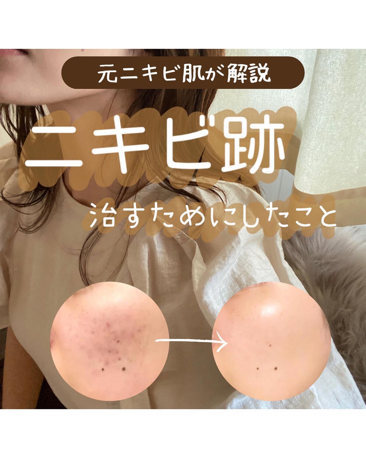 薬用クリアローション/IHADA/化粧水を使ったクチコミ（1枚目）