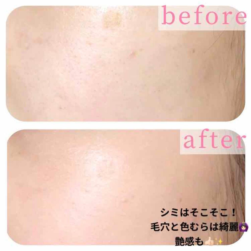 モイスチャーロゼファンデーションUV/コフレドール/クリーム・エマルジョンファンデーションを使ったクチコミ(6枚目)