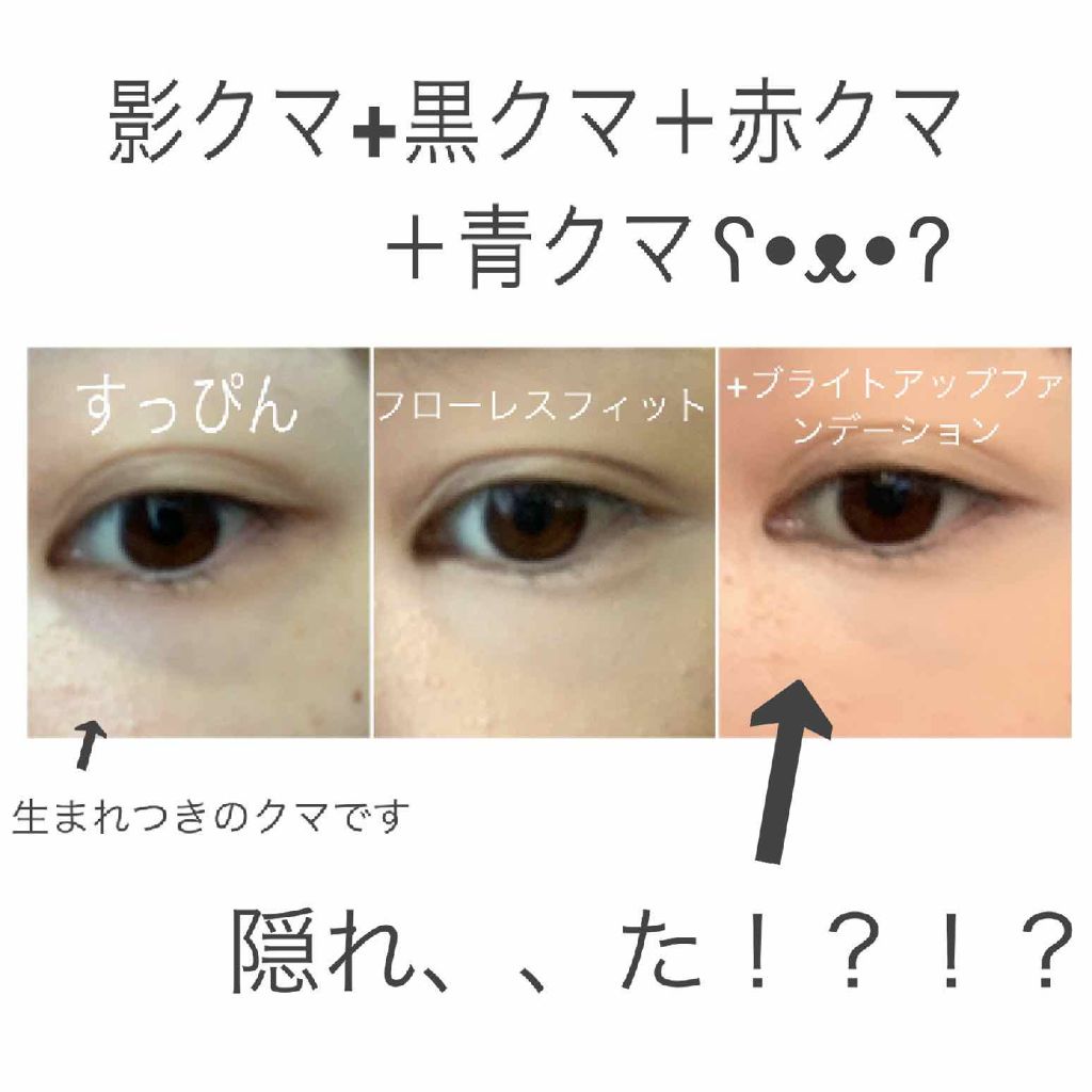 ブライトアップファンデーション/COVERMARK/スティックコンシーラーを使ったクチコミ(1枚目)