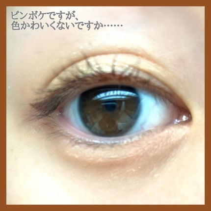 ãå¯çã¢ã€ã©ã€ããŒãã·ã§ãŒãçãªããã/ããžã£ãŽã¥/ãªãããã¢ã€ã©ã€ããŒã䜿ã£ãã¯ãã³ãïŒ2æç®ïŒ