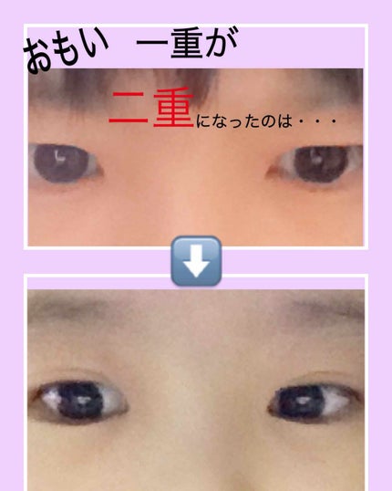 ナイトアイボーテ/StreeTrend/二重まぶた用アイテムを使ったクチコミ(1枚目)