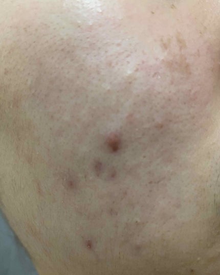 Cセラム/b.glen/美容液を使ったクチコミ(2枚目)