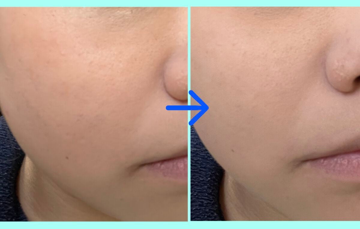 オペラ リップティント N/OPERA/リップティントを使ったクチコミ(2枚目)