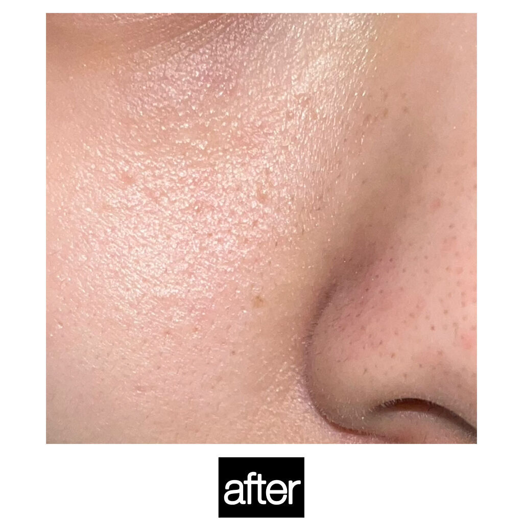 お米のパック/毛穴撫子/洗い流すパック・マスクを使ったクチコミ（3枚目）