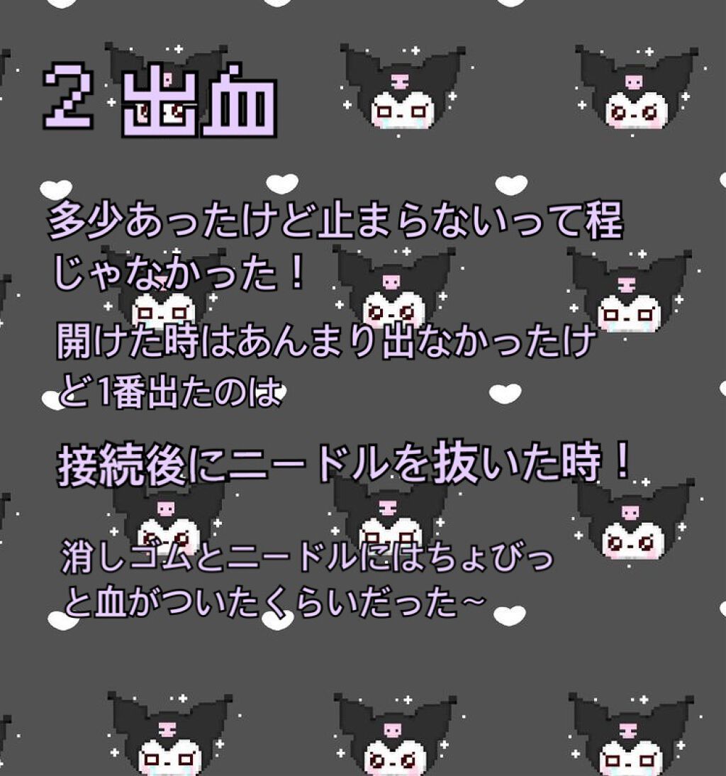 まほろ on LIPS 「【ヘリックス開通!痛みは?!発狂?!】ピアス体験記第2弾部位:..」(4枚目)