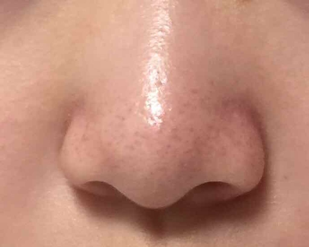 オバジC 酵素洗顔パウダー/オバジ/洗顔パウダーを使ったクチコミ（2枚目）