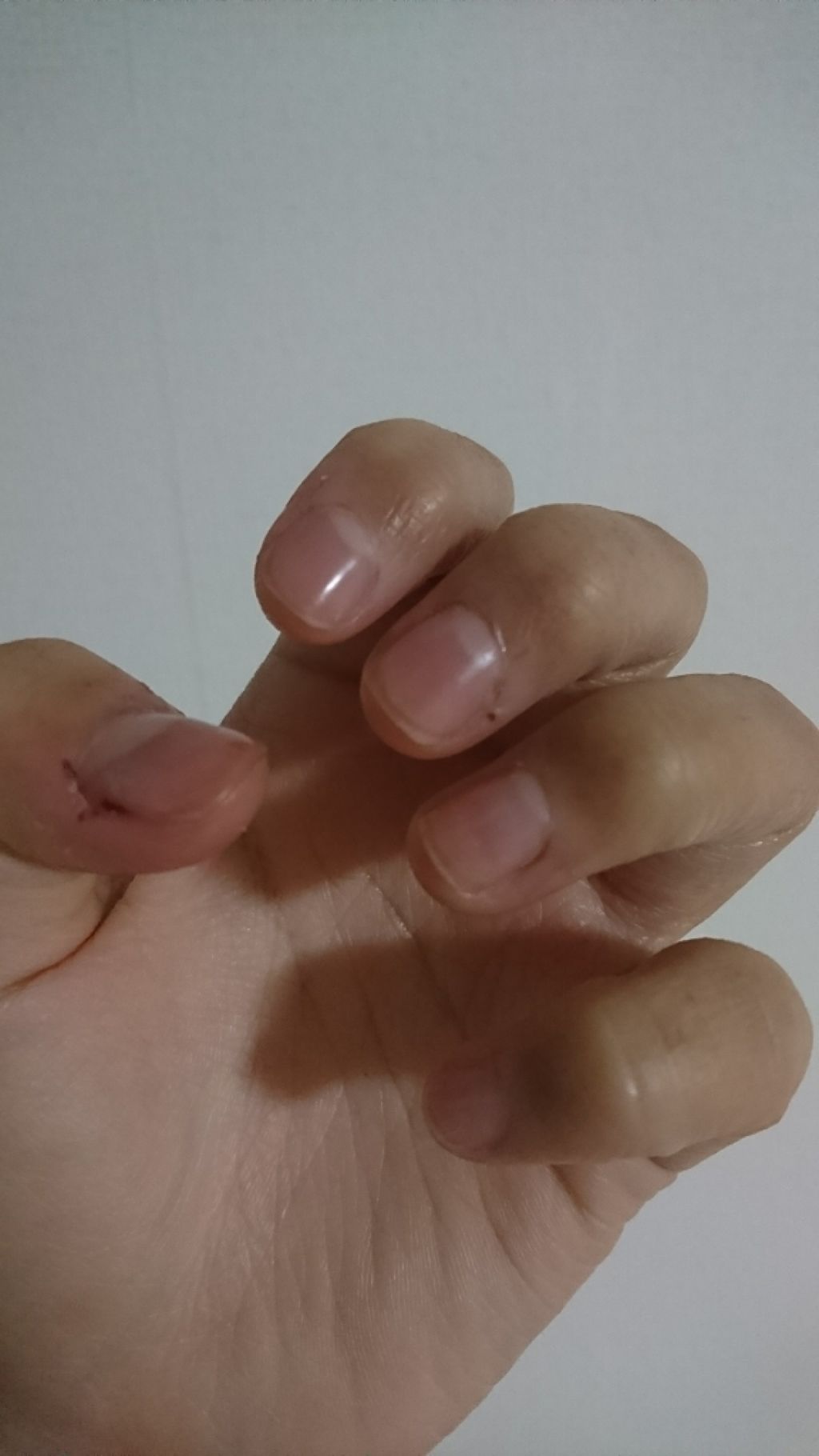 ネイルトリートメント N ネイルネイルの口コミ 男爪から女爪へ 写真は無加工です 手入れ By ぐらむ 混合肌 代前半 Lips