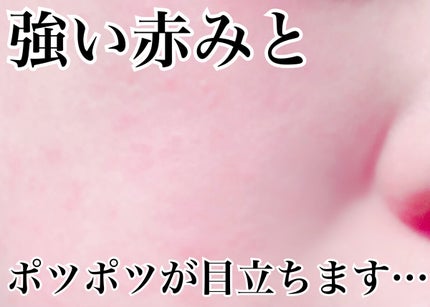 ミラミン/ZO Skin Health/フェイスクリームを使ったクチコミ(2枚目)