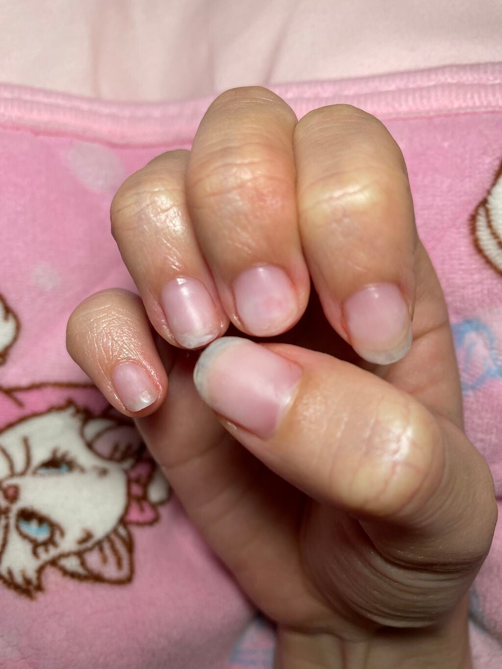 メディケイティッド エクストラクリーム/アトリックス/ハンドクリームを使ったクチコミ(1枚目)